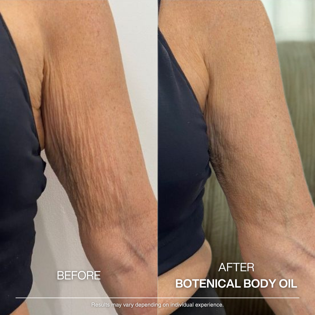 Botanical Body Oil™