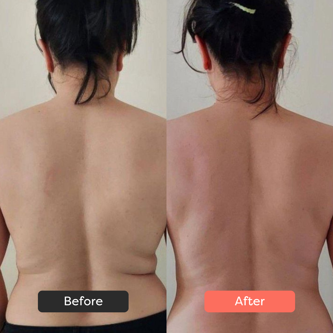 Thermoslim Body Sculpting Device