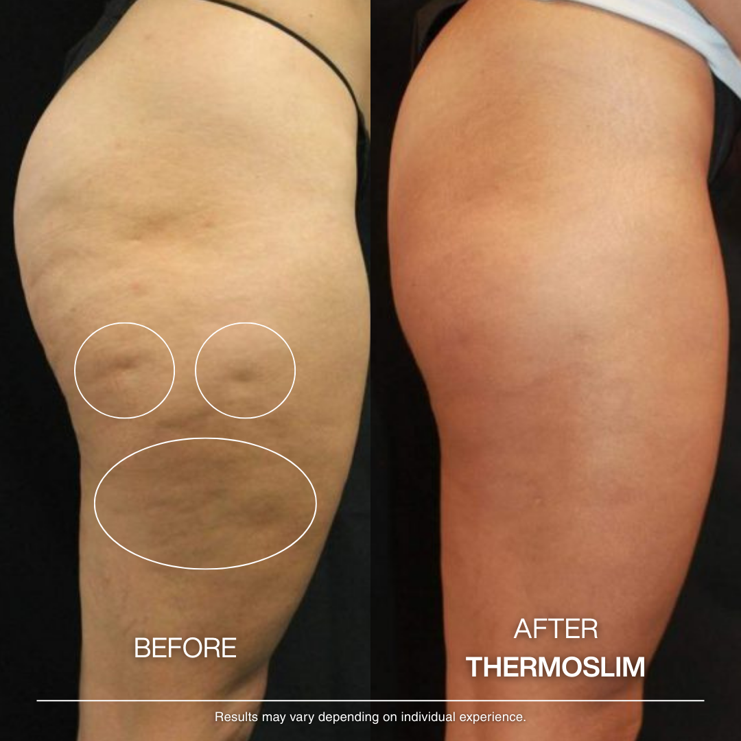 Thermo Anti-Cellulite Massage Oil