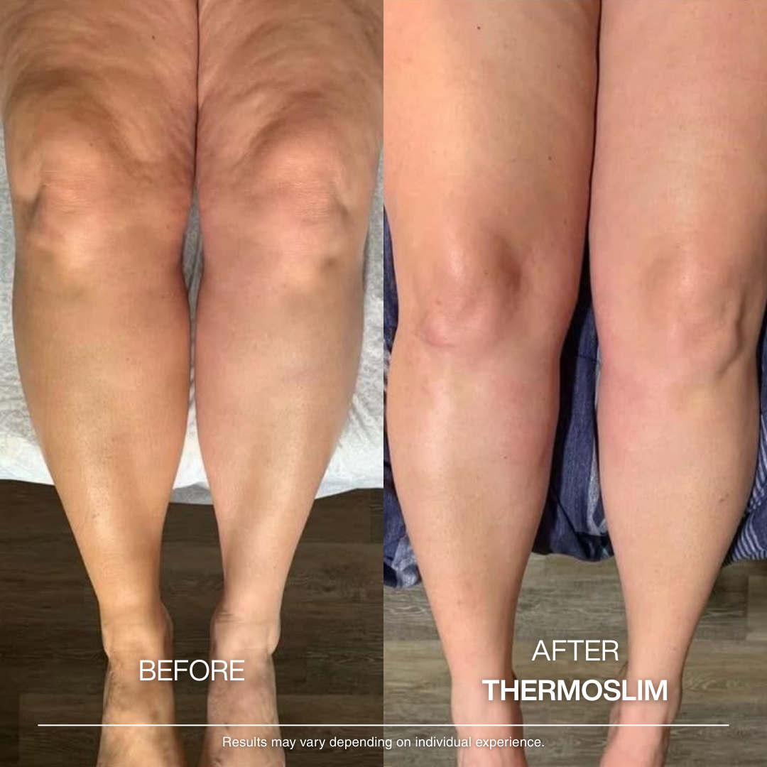 Thermo Anti-Cellulite Massage Oil