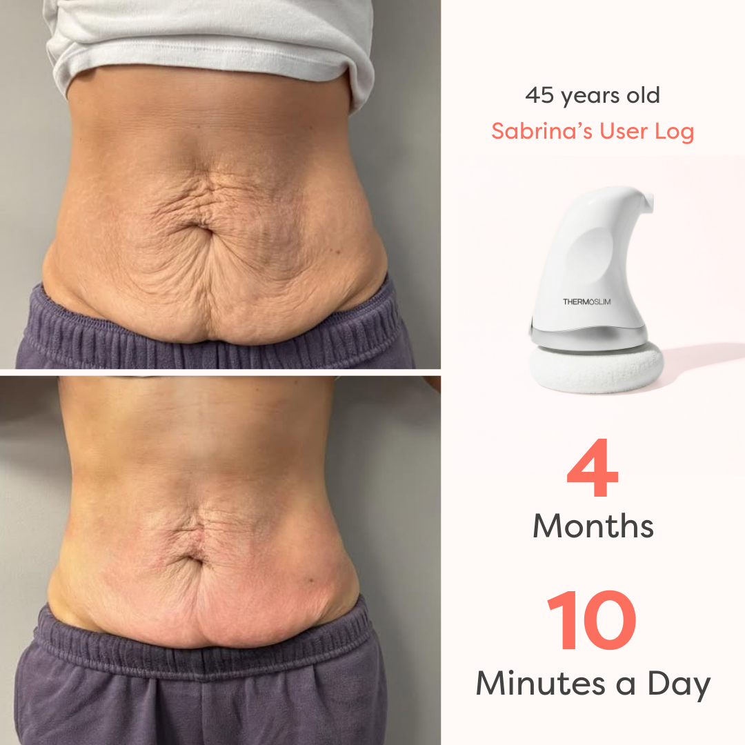 Thermo Body Tightening™